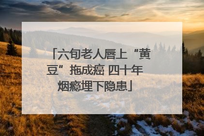 六旬老人唇上“黄豆”拖成癌 四十年烟瘾埋下隐患